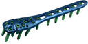 Proximal Humerus Locking Plate