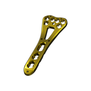 Distal Radius Volar Plate
