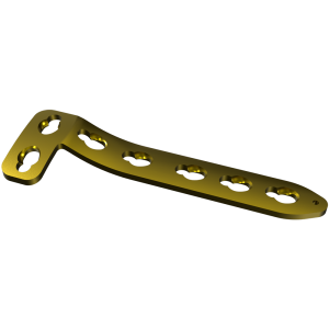 L Buttress Locking Plate