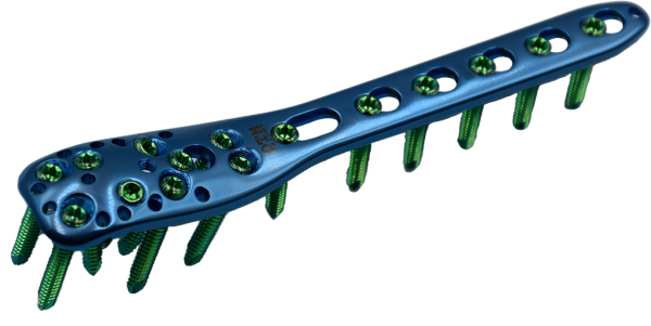 Proximal Humerus Locking Plate